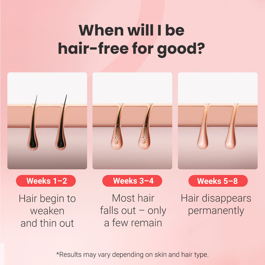 Permanent hair removal device